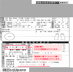 子宮頸がん検診の結果